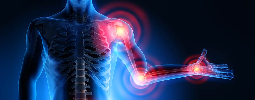 Chiropractic Considerations for Arthritis